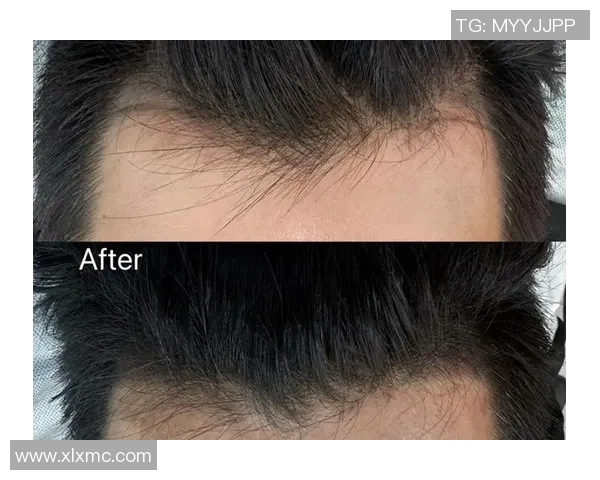 足球场上的M字发际线明星们如何逆袭成就辉煌人生