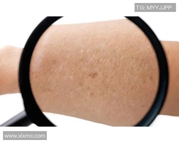 足球发霉的奇特现象探讨及其对运动员健康的影响分析